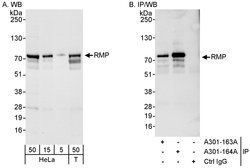 RMP Rabbit anti-Human, Polyclonal, Bethyl Laboratories 100 &mu;L; Unconjugated:Antibodies,