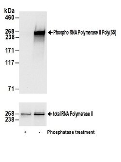 Phospho-RNA Polymerase II (Ser5) Polyclonal Antibody, Bethyl Laboratories 20 &mu;L | Buy Online | Bethyl Laboratories, Inc | Fisher Scientific