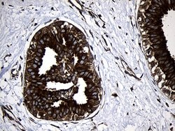 RNASE11 Monoclonal Antibody (OTI2C11), TrueMAB , OriGene:Antibodies:Primary