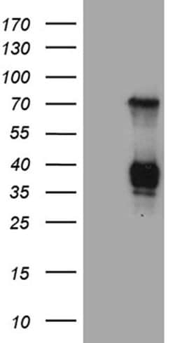 RNASE11 Monoclonal Antibody (OTI2H4), TrueMAB , OriGene:Antibodies:Primary