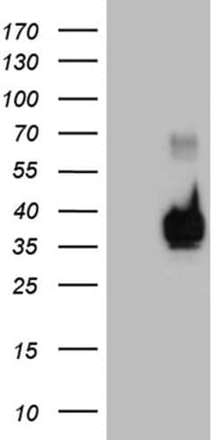 RNASE11 Monoclonal Antibody (OTI11E11), TrueMAB , OriGene 100 &mu;L; Unconjugated:Antibodies,