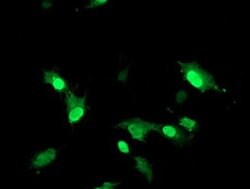 RNF113B Monoclonal Antibody (OTI2H5), TrueMAB , OriGene 100 &mu;L; Unconjugated:Antibodies,