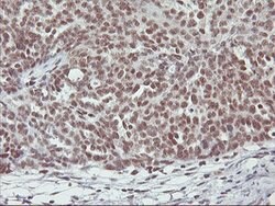 RNF113B Mouse anti-Human, Clone: OTI7A1, lyophilized, TrueMAB 100 &mu;g;