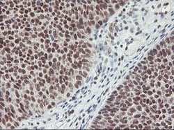 RNF113B Mouse anti-Human, Clone: OTI7A1, lyophilized, TrueMAB 100 &mu;g;