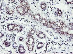 RNF113B Monoclonal Antibody (OTI2H5), TrueMAB , OriGene 100 &mu;L; Unconjugated:Antibodies,