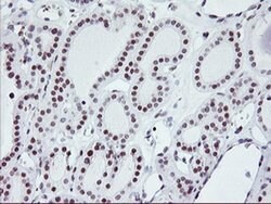 RNF113B Monoclonal Antibody (OTI2H5), TrueMAB , OriGene 100 &mu;L; Unconjugated:Antibodies,