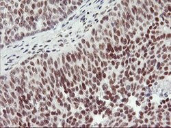 RNF113B Monoclonal Antibody (OTI2H5), TrueMAB , OriGene 100 &mu;L; Unconjugated:Antibodies,