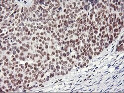 RNF113B Monoclonal Antibody (OTI1B10), TrueMAB , OriGene 30 &mu;L; Unconjugated:Antibodies,