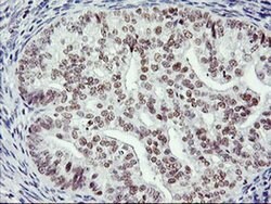 RNF113B Monoclonal Antibody (OTI1B10), TrueMAB , OriGene 30 &mu;L; Unconjugated:Antibodies,