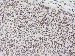 RNF113B Monoclonal Antibody (OTI1B10), TrueMAB , OriGene 30 &mu;L; Unconjugated:Antibodies,