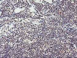 RNF113B Monoclonal Antibody (OTI1B10), TrueMAB , OriGene 30 &mu;L; Unconjugated:Antibodies,