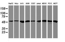 RNF113B Mouse anti-Human, Clone: OTI7A1, lyophilized, TrueMAB 100 &mu;g;