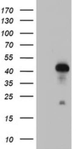 RNF113B Monoclonal Antibody (OTI2H5), TrueMAB , OriGene 100 &mu;L; Unconjugated:Antibodies,