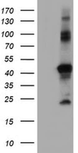 RNF113B Monoclonal Antibody (OTI1B10), TrueMAB , OriGene 30 &mu;L; Unconjugated:Antibodies,