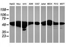 RNF113B Monoclonal Antibody (OTI1B10), TrueMAB , OriGene 30 &mu;L; Unconjugated:Antibodies,
