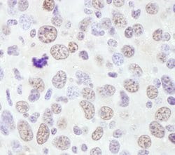 RNF138 Rabbit anti-Human, Mouse, Polyclonal, Bethyl Laboratories 10 &mu;L;