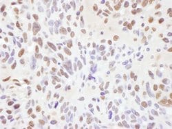 RNF138 Rabbit anti-Human, Mouse, Polyclonal, Bethyl Laboratories 10 &mu;L;
