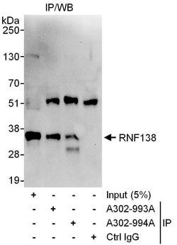 RNF138 Rabbit anti-Human, Polyclonal, Bethyl Laboratories 100 &mu;L; Unconjugated:Antibodies,