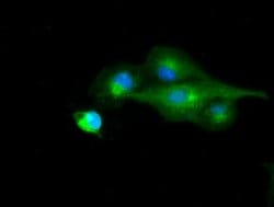 RNF144B Mouse anti-Human, Clone: OTI3C2, lyophilized, TrueMAB 100 &mu;g;