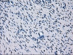 RNF144B Mouse anti-Human, Clone: OTI9H10, lyophilized, TrueMAB 100 &mu;g | Buy Online | Origene Technologies | Fisher Scientific