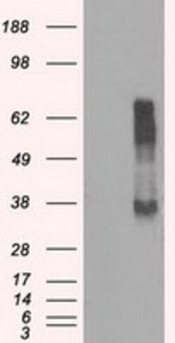 RNF144B Mouse anti-Human, Clone: OTI3C2, lyophilized, TrueMAB 100 &mu;g;