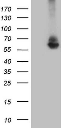 RNF149 Monoclonal Antibody (OTI10B3), TrueMAB , OriGene 30 &mu;L | Buy Online | Origene Technologies | Fisher Scientific