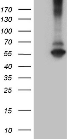 RNF149 Mouse anti-Human, Clone: OTI11H7, lyophilized, TrueMAB 100 &mu;g;