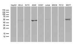 RNF149 Mouse anti-Human, Clone: OTI9F11, liquid, TrueMAB 100 &mu;L; Unconjugated:Antibodies,