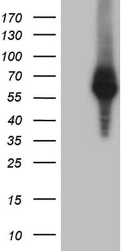 RNF149 Monoclonal Antibody (OTI12C2), TrueMAB , OriGene 100 &mu;L; Unconjugated:Antibodies,