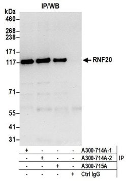 RNF20 Rabbit anti-Human, Mouse, Polyclonal, Bethyl Laboratories 100 &mu;l;