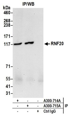 RNF20 Rabbit anti-Human, Mouse, Polyclonal, Bethyl Laboratories 100 &mu;L;