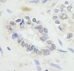 RNF20 Polyclonal Antibody, Bethyl Laboratories 100 &mu;l; Unlabeled:Antibodies,