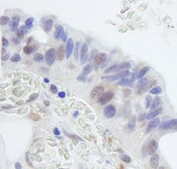 RNF20 Polyclonal Antibody, Bethyl Laboratories 100 &mu;l; Unlabeled:Antibodies,
