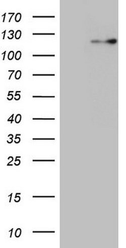 RNF20 Mouse anti-Human, Clone: OTI13A10, lyophilized, TrueMAB 100 &mu;g;
