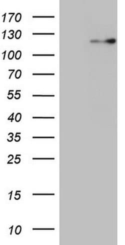 RNF20 Monoclonal Antibody (OTI13A10), TrueMAB , OriGene:Antibodies:Primary