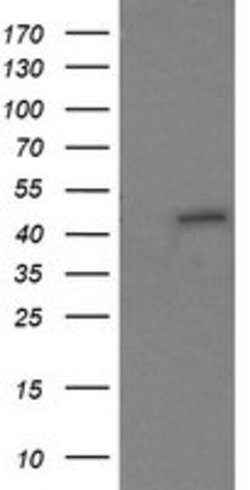 RNF39 Mouse anti-Human, Clone: OTI4D3, lyophilized, TrueMAB 100 &mu;g;
