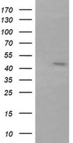 RNF39 Monoclonal Antibody (OTI5F5), TrueMAB , OriGene:Antibodies:Primary