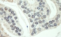 RNF40 Rabbit anti-Human, Polyclonal, Bethyl Laboratories 100 &mu;L; Unconjugated:Antibodies,