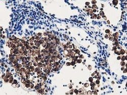 RNH1 Mouse anti-Human, Clone: OTI4G4, lyophilized, TrueMAB 100 &mu;g; Unconjugated:Antibodies,