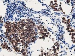 RNH1 Monoclonal Antibody (OTI4G4), TrueMAB , OriGene 100 &mu;L; Unconjugated:Antibodies,
