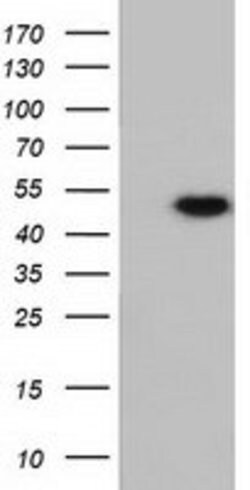 RNH1 Mouse anti-Human, Clone: OTI4G4, lyophilized, TrueMAB 100 &mu;g; Unconjugated:Antibodies,