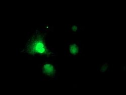 RNPEP Monoclonal Antibody (OTI3B5), TrueMAB , OriGene 100 &mu;L; Unconjugated:Antibodies,