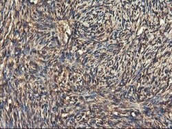 RNPEP Monoclonal Antibody (OTI3B5), TrueMAB , OriGene 100 &mu;L; Unconjugated:Antibodies,
