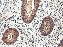 RNPEP Monoclonal Antibody (OTI3B5), TrueMAB , OriGene 100 &mu;L; Unconjugated:Antibodies,