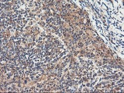 RNPEP Monoclonal Antibody (OTI3B5), TrueMAB , OriGene 100 &mu;L; Unconjugated:Antibodies,