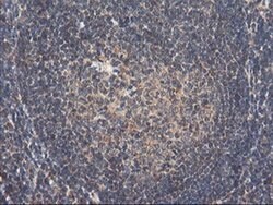 RNPEP Monoclonal Antibody (OTI3B5), TrueMAB , OriGene 100 &mu;L; Unconjugated:Antibodies,