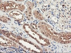 RNPEP Monoclonal Antibody (OTI3B5), TrueMAB , OriGene 100 &mu;L; Unconjugated:Antibodies,