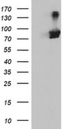 RNPEP Monoclonal Antibody (OTI2G3), TrueMAB , OriGene 100 &mu;L; Unconjugated:Antibodies,