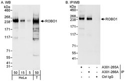 ROBO1 Rabbit anti-Human, Polyclonal, Bethyl Laboratories 100 &mu;L; Unconjugated:Antibodies,