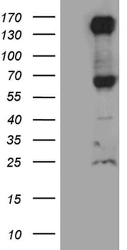 ROBO4 Mouse anti-Human, Clone: OTI4E2, lyophilized, TrueMAB 100 &mu;g;